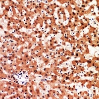Adrenomedullin Rabbit Polyclonal Antibody