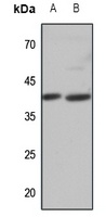 APJ Rabbit Polyclonal Antibody
