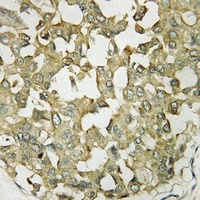 APJ Rabbit Polyclonal Antibody