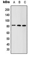 ABCD1 Rabbit Polyclonal Antibody