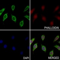 Annexin A2 (Phospho-S26) Rabbit Polyclonal Antibody
