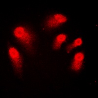 AIRE Rabbit Polyclonal Antibody