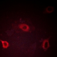 Beta Amyloid (Phospho-T743) Antibody