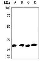 Aquaporin 1 Rabbit Polyclonal Antibody