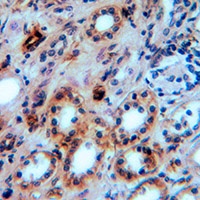 Aquaporin 1 Rabbit Polyclonal Antibody