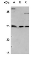 ARF4 Rabbit Polyclonal Antibody