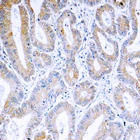 ARF4 Rabbit Polyclonal Antibody