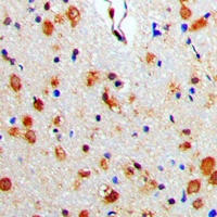 Beta-arrestin-1 Rabbit Polyclonal Antibody