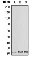 ATF3 Rabbit Polyclonal Antibody