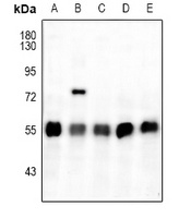 ATF4 (Phospho-S245) Rabbit Polyclonal Antibody