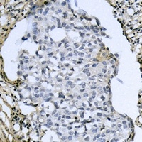 ATF4 (Phospho-S245) Rabbit Polyclonal Antibody