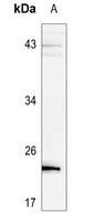 BAD (Phospho-S136) Rabbit Polyclonal Antibody
