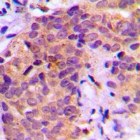 BAD (Phospho-S136) Rabbit Polyclonal Antibody