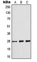 BCL2 (Phospho-S70) Rabbit Polyclonal Antibody