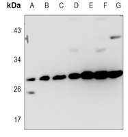 BCLW Rabbit Polyclonal Antibody
