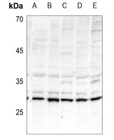 BIK (Phospho-T33) Rabbit Polyclonal Antibody