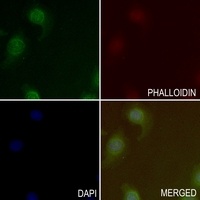 B-RAF Rabbit Polyclonal Antibody