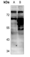 BTK (Phospho-Y223) Rabbit Polyclonal Antibody