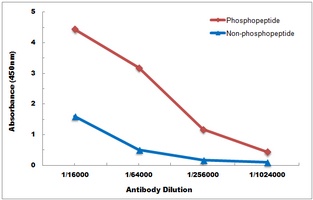 BTK (Phospho-Y223) Rabbit Polyclonal Antibody