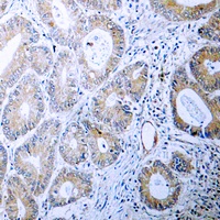 Calreticulin Rabbit Polyclonal Antibody