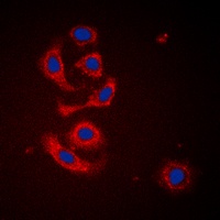 Calreticulin Rabbit Polyclonal Antibody