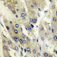 Catalase (Phospho-Y386) Rabbit Polyclonal Antibody