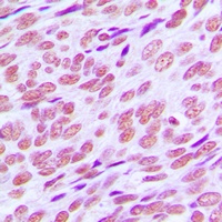 Cyclin E1 Rabbit Polyclonal Antibody