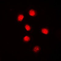Cyclin E1 Rabbit Polyclonal Antibody