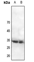 CDC2 (Phospho-Y15) Rabbit Polyclonal Antibody