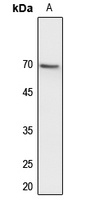 CDC25B Rabbit Polyclonal Antibody