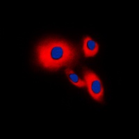 CDC25B Rabbit Polyclonal Antibody