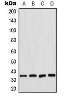CDK2 Rabbit Polyclonal Antibody