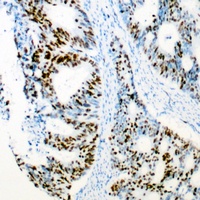 CDK2 Rabbit Polyclonal Antibody