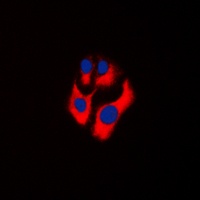 CKMT2 Rabbit Polyclonal Antibody