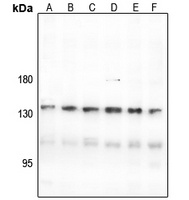 CNGB1 Rabbit Polyclonal Antibody