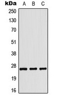 Tumstatin Rabbit Polyclonal Antibody