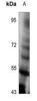 TPL2 (Phospho-T290) Rabbit Polyclonal Antibody
