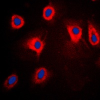 TPL2 (Phospho-T290) Rabbit Polyclonal Antibody