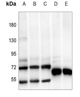 ATF2 Rabbit Polyclonal Antibody