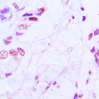 ATF2 Rabbit Polyclonal Antibody