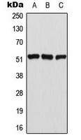 ATF2 (Phospho-T69) Rabbit Polyclonal Antibody