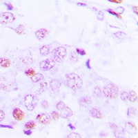 ATF2 (Phospho-T69) Rabbit Polyclonal Antibody