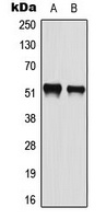 ATF2 (Phospho-S112) Rabbit Polyclonal Antibody