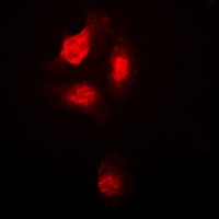 p38 (Phospho-T180) Antibody