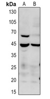 p38 (Phospho-T180) Antibody