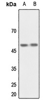CSK Rabbit Polyclonal Antibody