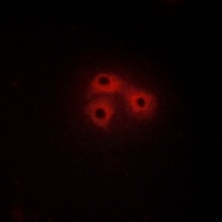 CSK Rabbit Polyclonal Antibody