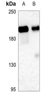 CD143 Rabbit Polyclonal Antibody