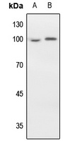 EEF2 Rabbit Polyclonal Antibody