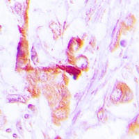 EEF2 Rabbit Polyclonal Antibody